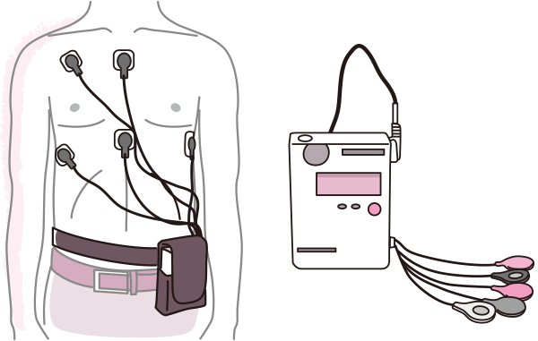 24時間のホルダー心電図検査